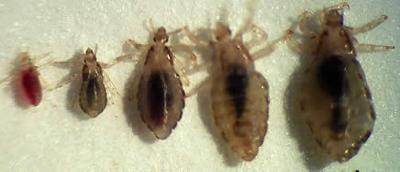 Picture of Body Lice (by Nutraceuticals)
