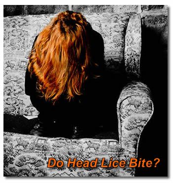 Do Head Lice Bite?