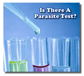 What Kind Of Parasite Tests Are There?