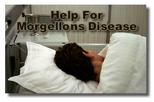 Morgellons Disease