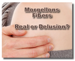 Morgellons Fiber Disease