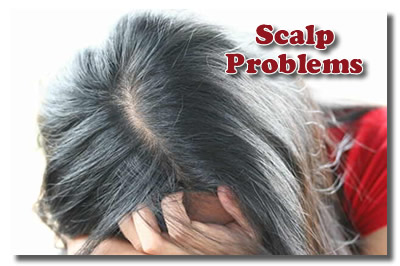 Dealing With Scalp Problems