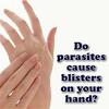 Would a parasite give you a recuring blister on your finger?