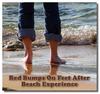 Mysterious red bumps on feet after being in the ocean and beach...
