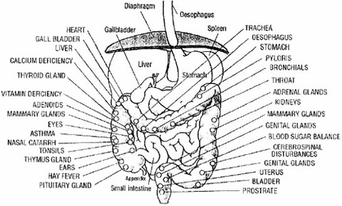 diagram of colon problems