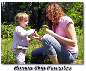 dealing with human skin parasites