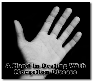 Morgellon Disease