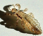 head lice symptoms