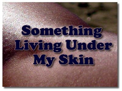 Something Living Under My Skin - I don't know what it is!