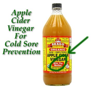 Natural Remedy For Cold Sore Prevention
